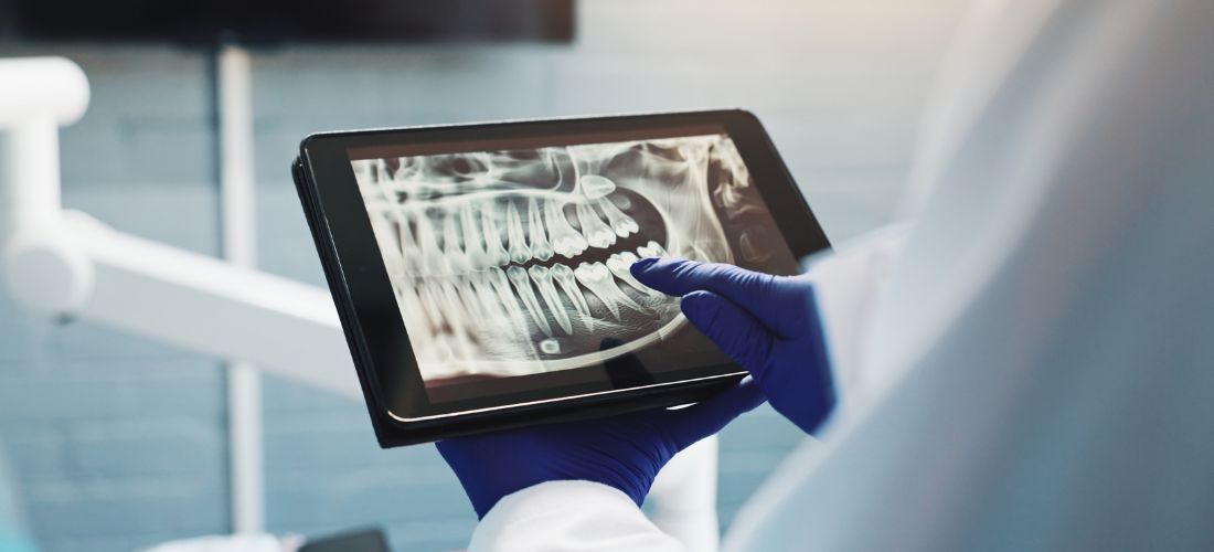 8 señales de alerta de problemas dentales